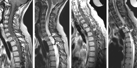 perifériás ízületek artrózisa fájdalom a jobb hátban hátulról a derék alatt